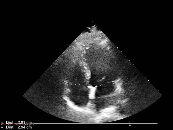 Tela da máquina de ecocardiografia (ultra-som) . — Fotografia de Stock