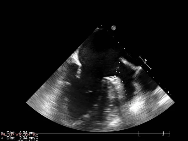 Scherm van echocardiografie (echografie) machine. — Stockfoto