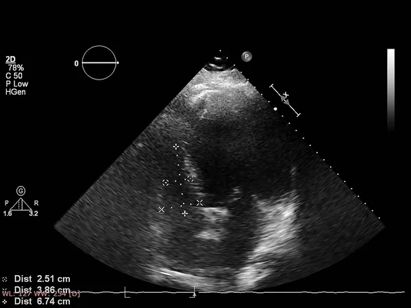 Écran de la machine d'échocardiographie (échographie) . — Photo