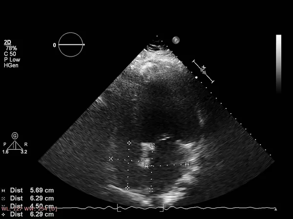 Écran de la machine d'échocardiographie (échographie) . — Photo