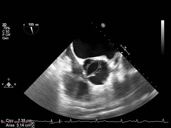 Pantalla de la máquina de ecocardiografía (ultrasonido) . —  Fotos de Stock