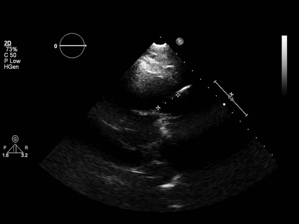 超声心动图（超声）机屏幕. — 图库照片