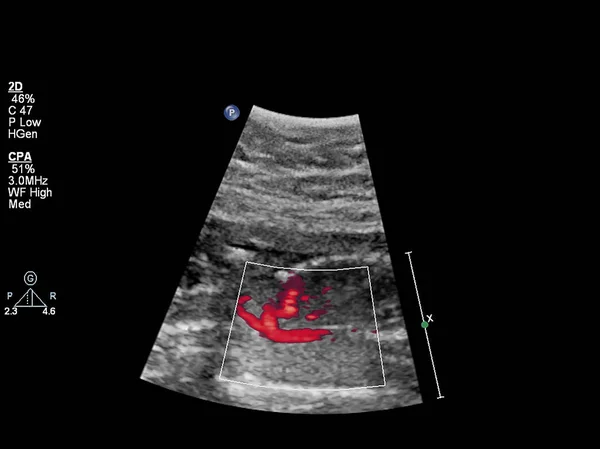 Ultraschalluntersuchung des fetalen Herzens — Stockfoto
