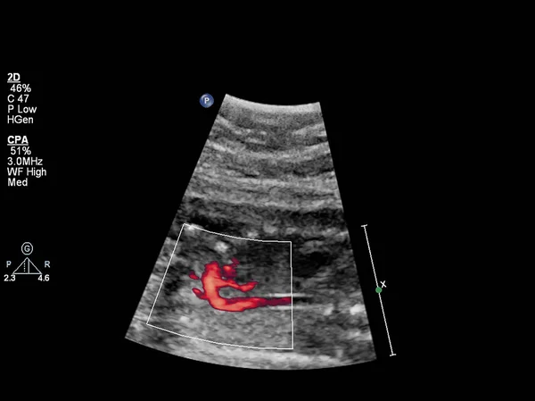 Exame ultrassonográfico do coração fetal — Fotografia de Stock