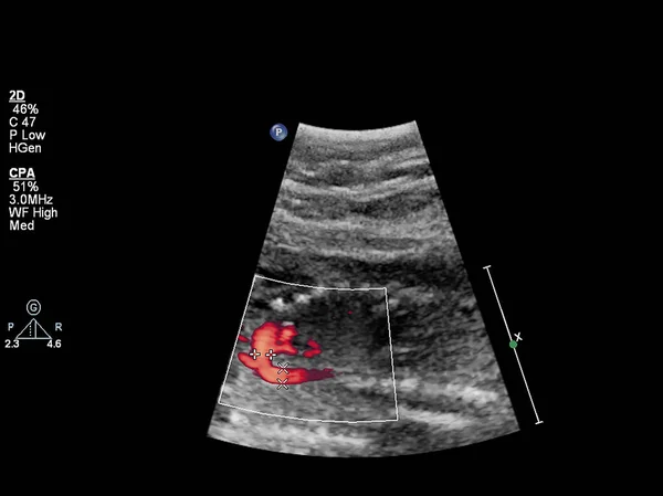 Ultrasound examination of the fetal heart — Stock Photo, Image