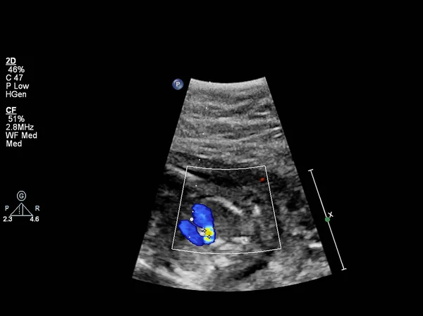 Fetal kalbin ultrason muayenesi — Stok fotoğraf
