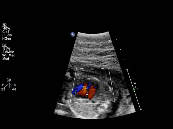 Exame ultrassonográfico do coração fetal — Fotografia de Stock