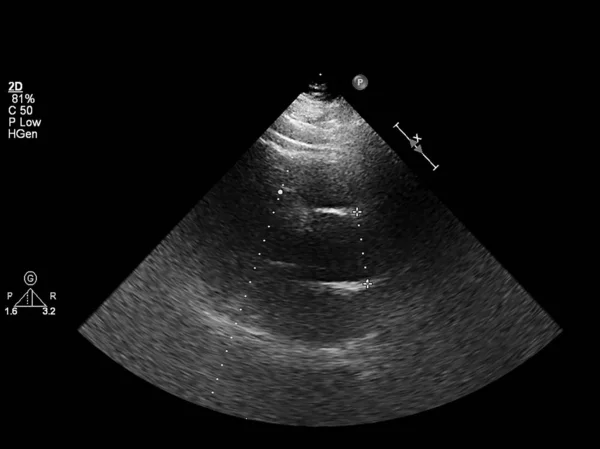 心エコー検査(超音波)マシンの画面. — ストック写真