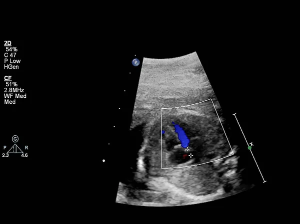 Exame ultrassonográfico do coração fetal — Fotografia de Stock