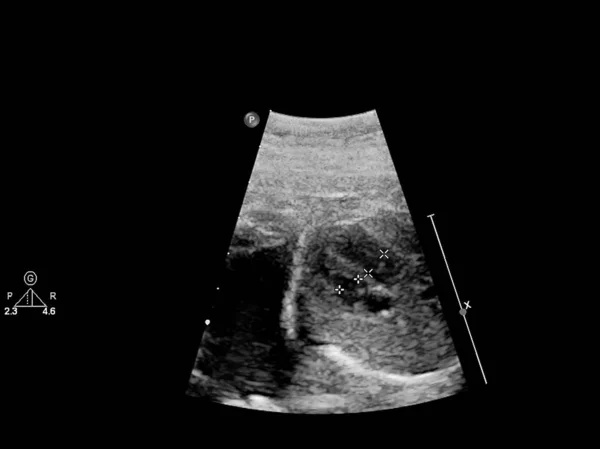 태아 심장의 초음파 검사 — 스톡 사진