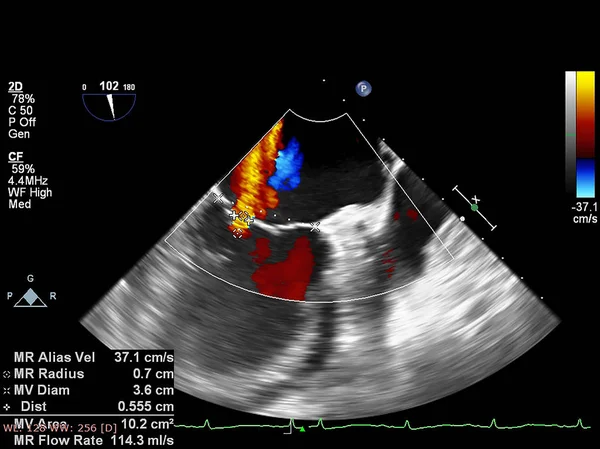 Pantalla de la máquina de ecocardiografía (ultrasonido) . —  Fotos de Stock