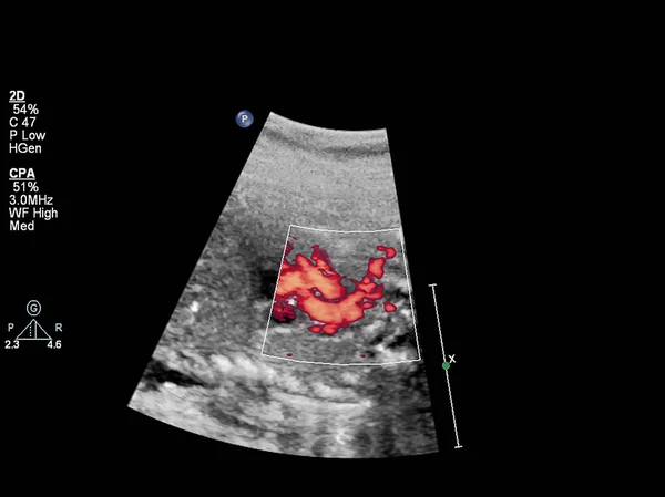 Exame ultrassonográfico do coração fetal . — Fotografia de Stock