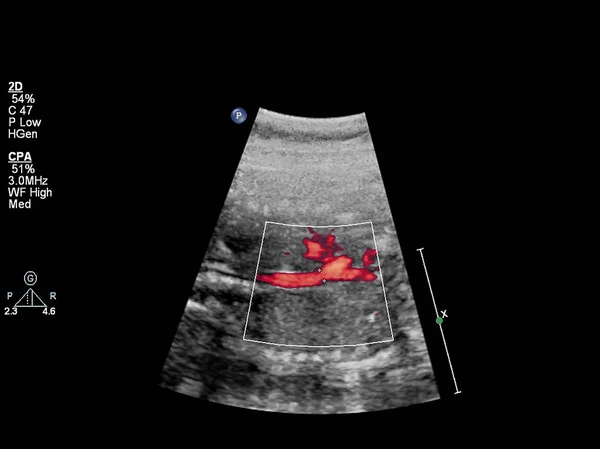Exame ultrassonográfico do coração fetal . — Fotografia de Stock