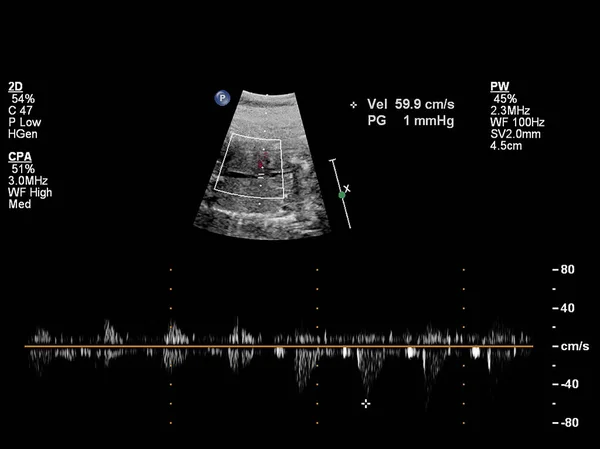 Ultraschalluntersuchung des fetalen Herzens. — Stockfoto
