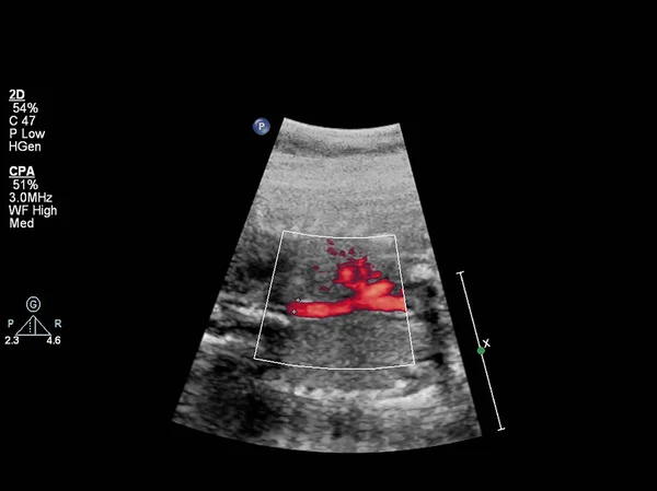 Ultrasound examination of the fetal heart. — Stock Photo, Image