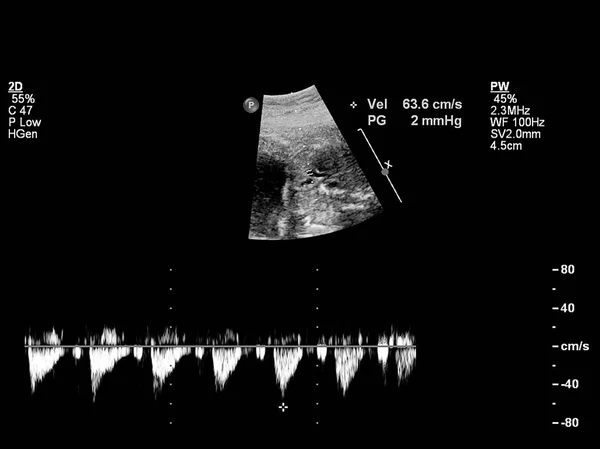 Magzati szív ultrahang vizsgálata. — Stock Fotó