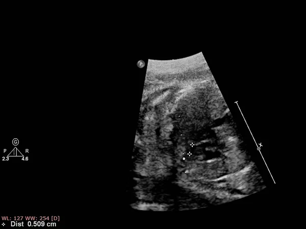 胎儿心脏的超声检查. — 图库照片
