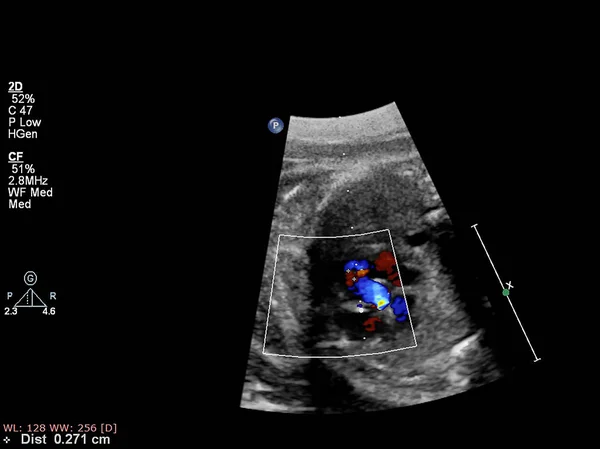 Exame ultrassonográfico do coração fetal . — Fotografia de Stock