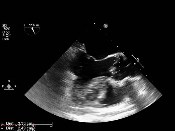 Οθόνη ηχοκαρδιογραφίας (υπερήχων) μηχανή. — Φωτογραφία Αρχείου
