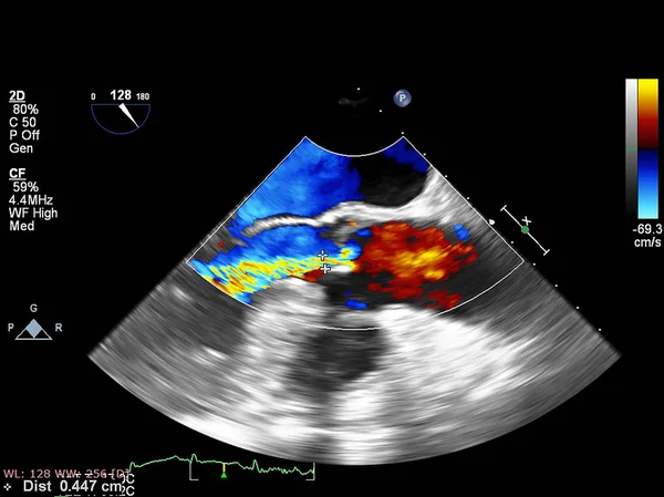 Screen of echocardiography (ultrasound) machine. — Stock Photo, Image