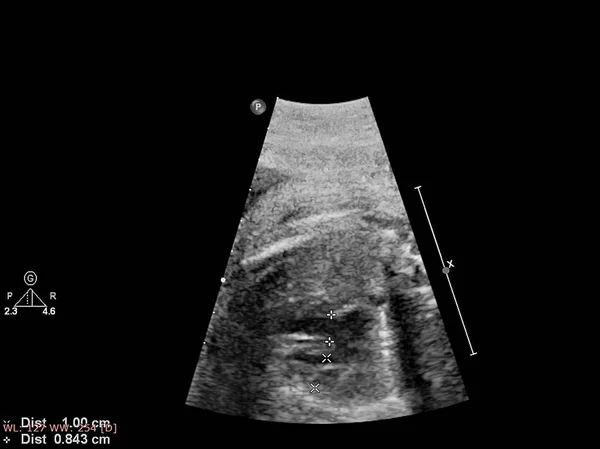 Exame ultrassonográfico do coração fetal — Fotografia de Stock