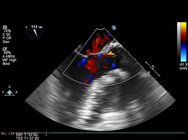 Tela da máquina de ecocardiografia (ultra-som) . — Fotografia de Stock