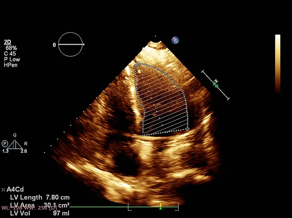 Bildschirm der Echokardiographie (Ultraschall) Maschine. — Stockfoto