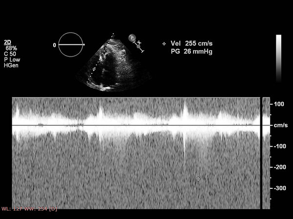 Экран эхокардиографической (ультразвуковой) машины
.