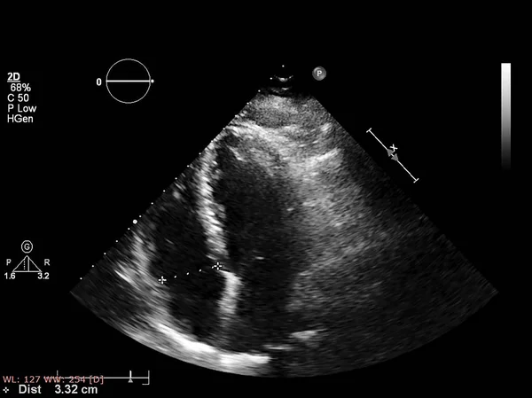 Écran de la machine d'échocardiographie (échographie) . — Photo