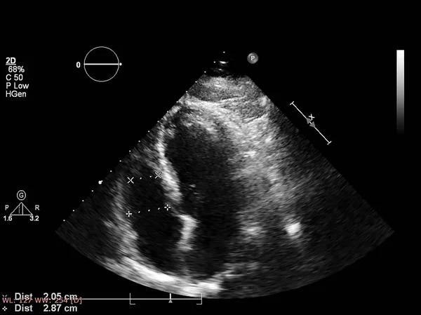 Écran de la machine d'échocardiographie (échographie) . — Photo