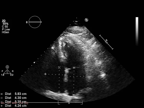 Tela da máquina de ecocardiografia (ultra-som) . — Fotografia de Stock