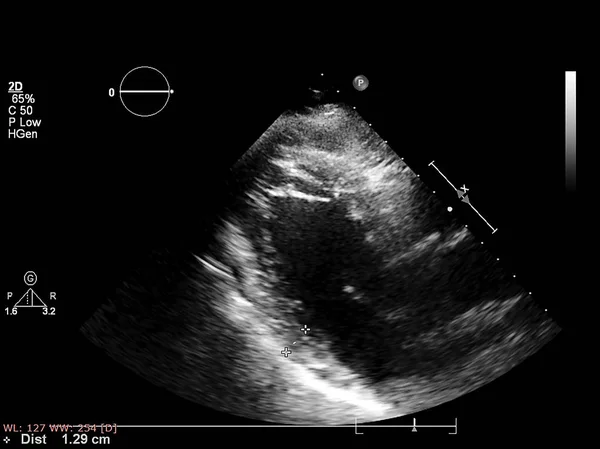 Écran de la machine d'échocardiographie (échographie) . — Photo