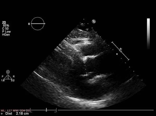 Tela da máquina de ecocardiografia (ultra-som) . — Fotografia de Stock