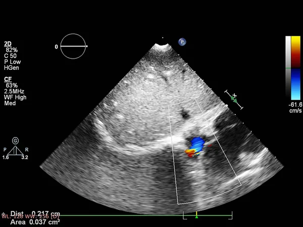 Écran de la machine d'échocardiographie (échographie) . — Photo