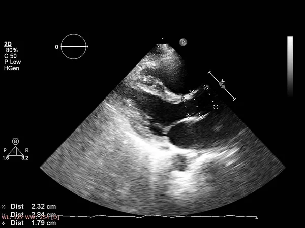 Écran de la machine d'échocardiographie (échographie) . — Photo