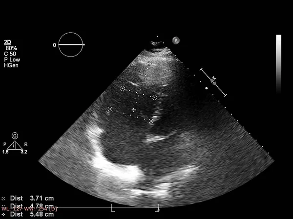 Écran de la machine d'échocardiographie (échographie) . — Photo