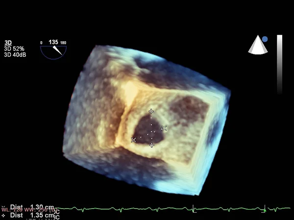 Échocardiographie 3D moderne . — Photo