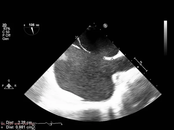 Écran de la machine d'échocardiographie (échographie) . — Photo