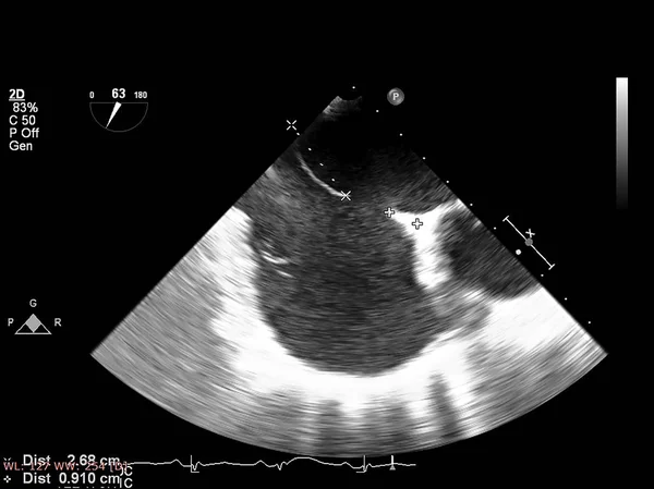 Οθόνη ηχοκαρδιογραφίας (υπερήχων) μηχανή. — Φωτογραφία Αρχείου