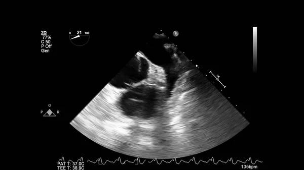 超声心动图（超声）机屏幕. — 图库照片