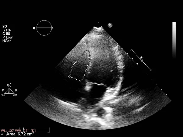 Écran de la machine d'échocardiographie (échographie) . — Photo