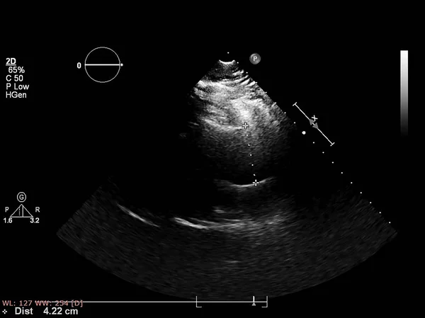 Tela da máquina de ecocardiografia (ultra-som) . — Fotografia de Stock