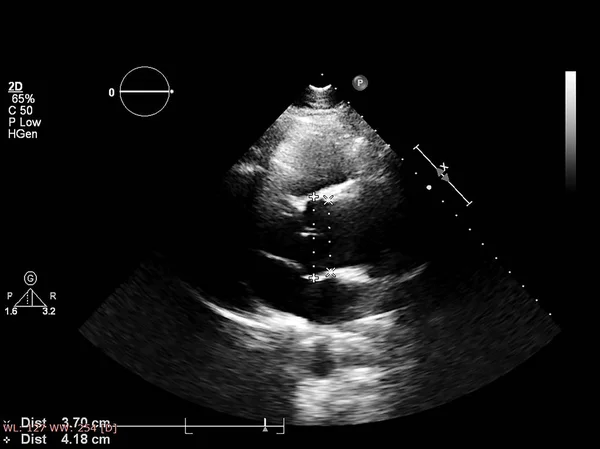 Tela da máquina de ecocardiografia (ultra-som) . — Fotografia de Stock