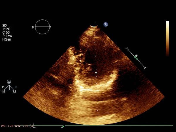 Οθόνη ηχοκαρδιογραφίας (υπερήχων) μηχανή. — Φωτογραφία Αρχείου