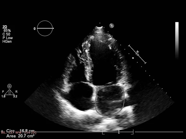 Scherm van echocardiografie (echografie) machine. — Stockfoto