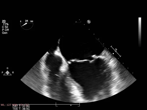 Mesin echocardiography (ultrasound) layar . — Stok Foto