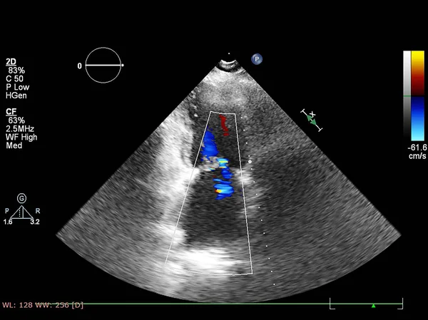 Ekran echokardiografii (USG) maszyny. — Zdjęcie stockowe