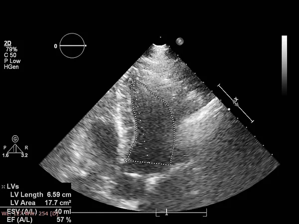 Écran de la machine d'échocardiographie (échographie) . — Photo