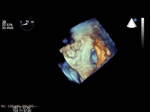 현대 3D 심초음파. — 스톡 사진