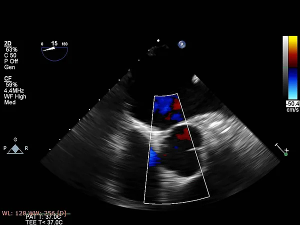 Ekokardiyografi (ultrason) makinesi nin ekranı. — Stok fotoğraf